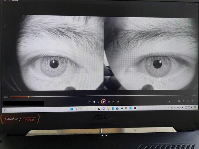 透过眼振仪观察眼球的震颤，帮助诊断出眩晕的原因。（大千医院提供／谢明俊苗栗传真）