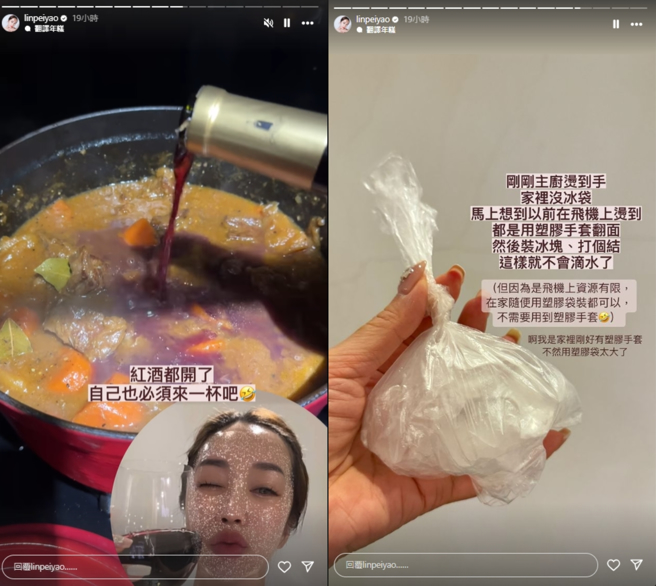 老公在家下廚燙傷，林佩瑤急用機上妙招替他冰鎮。（圖／林佩瑤IG）