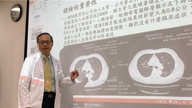 台中医院顾问医师钟威升指出，肺癌已连续2年高居10大癌症死因第1名，台湾癌症登记报告显示，肺癌早期发现早期治疗是关键。（台中医院提供／冯惠宜台中传真）