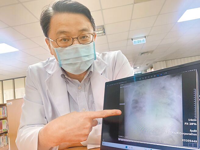 衛福部台中醫院感染科主任陳宗家表示，類鼻疽感染途徑有二，除傷口接觸到汙水，也可能是從鼻腔嗆水進入。（馮惠宜攝）