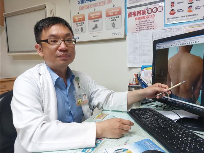台中光田綜合醫院大甲院區感染科陳俊志醫師表示，最近接獲不少成人水痘個案求診，這波感染多以20歲以上的成人為主，有的甚至在小時候打過疫苗。（照片由光田醫院提供）