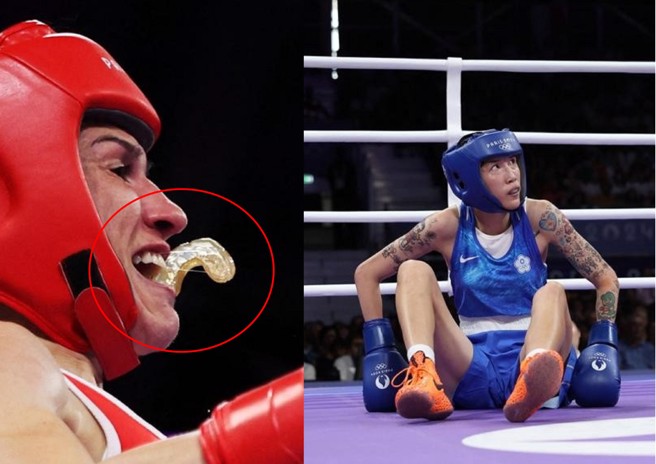 黃筱雯把對手牙套都打掉，卻因為被踩腳跌倒被判輸，台灣網友全氣炸！（合成圖／路透社）