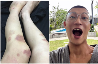 罔腰首公开遭凤梨「挥拳痛殴」影片　恐怖69秒：想好好过生活这么难