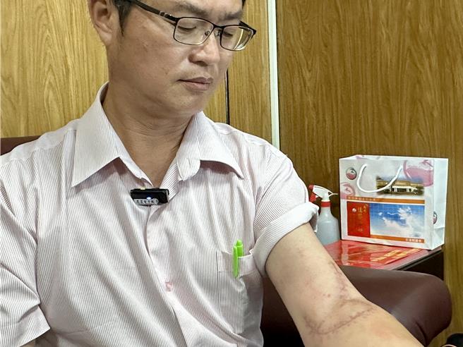 林源富出示被妻子持刀刺傷、縫合的傷口，表示目前一週仍要定期回診復健。（王志偉攝）