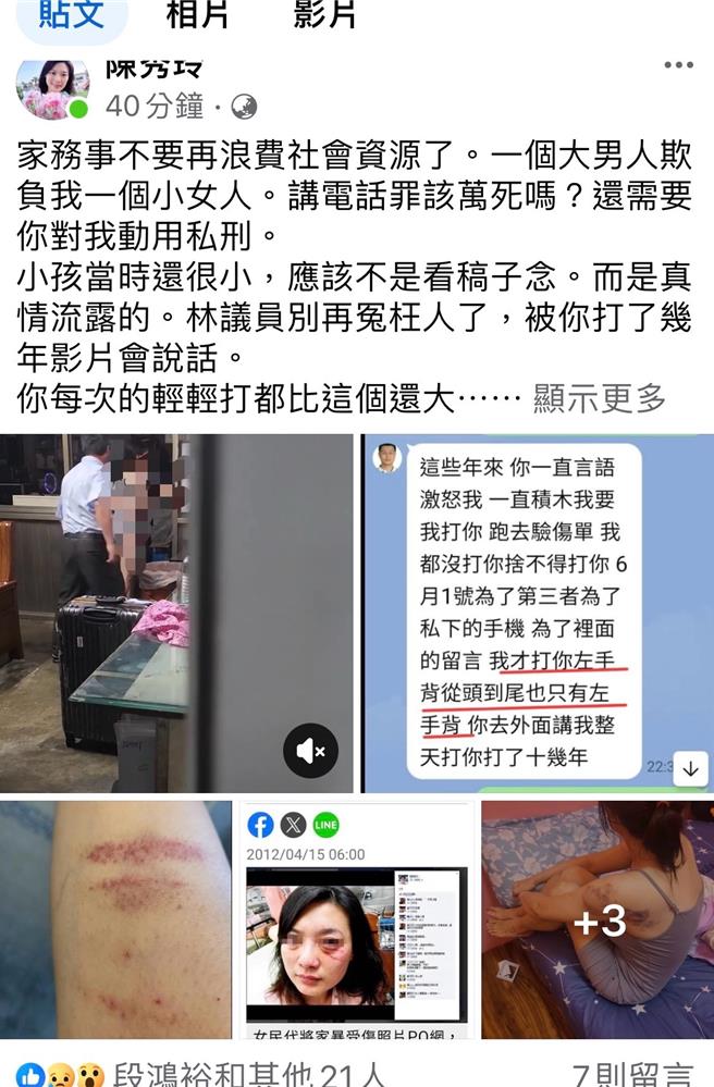 陳秀玲在臉書貼出疑遭林源富「動手」的畫面，指控林源富家暴。（摘自臉書）