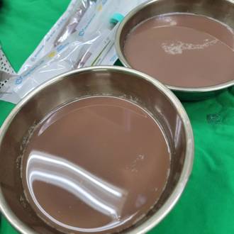 60岁男引出1公升「奶茶尿」 轻忽腰痛 下场超惨