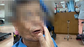 7旬翁戰勝鼻咽癌後遺症 吞嚥治療助其重獲健康