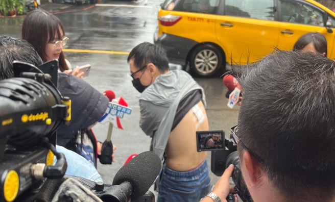 陳姓男子遭掉落的水泥塊砸中背部，還好傷勢不嚴重。（永和警分局提供）