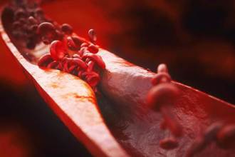 拯救血管硬化 醫激推1運動 8成心衰竭有望恢復正常