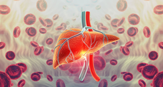 不喝酒也沒肝炎 70歲男肝指數狂飆 全因1物吃過量