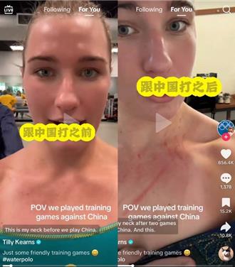 陸、澳女子水球隊互懟胸前血痕 陸隊長：對抗賽事誰也別說誰