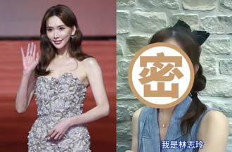 49歲林志玲「超V下巴」外型大變　濾鏡開太強網嚇壞：誰整的