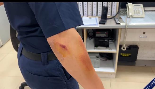所長右手肘擦挫傷。(讀者提供／曹婷婷台南傳真)