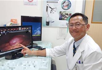 15歲少年狂嗑炸雞薯條 腹痛急診一看：膽囊快爆了