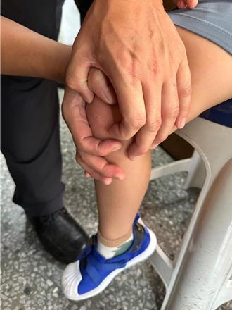 男童大湖公园遭蜜蜂螫伤 父衝入派出所求救！北市警协助送医