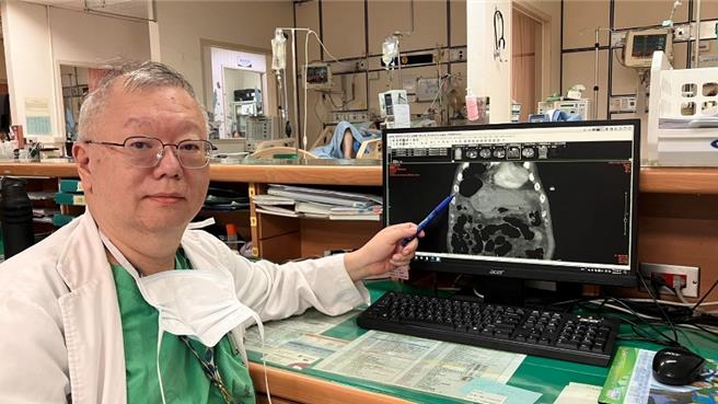 消化外科主任袁天民醫師指出，腹膜炎的髒腹水處並置放空腸餵食造口，讓張伯伯可以改善目前困境。（院方提供／李京昇台中傳真）