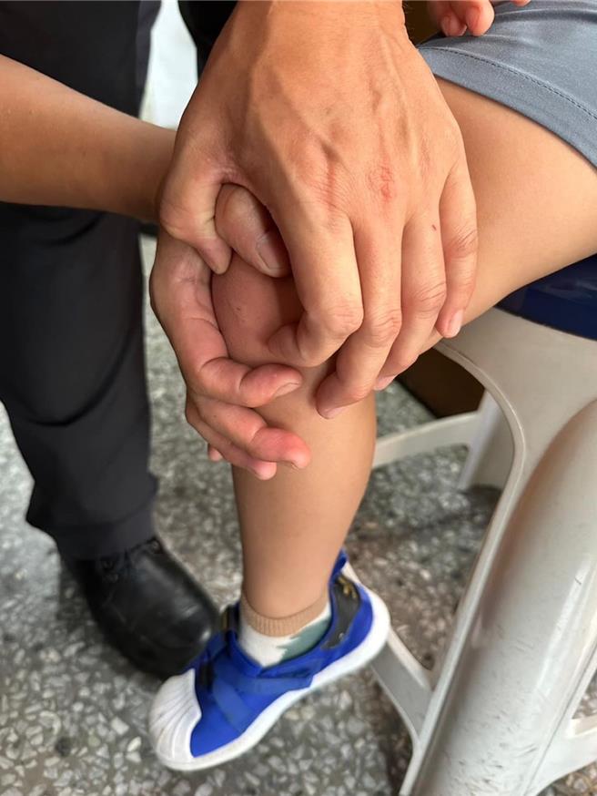 員警檢視小男童遭蜜蜂螫傷的傷勢。（翻攝照片／林郁平台北傳真））