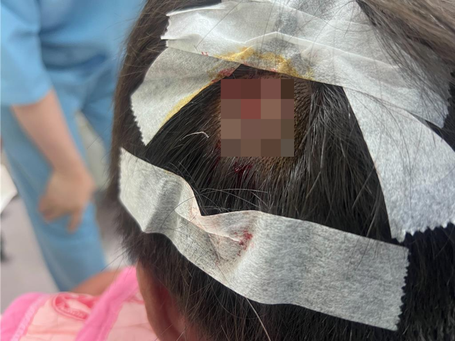 吴姓男子头部遭艺人「黑支」持椅子砸伤。（民眾提供／孙英哲彰化传真）