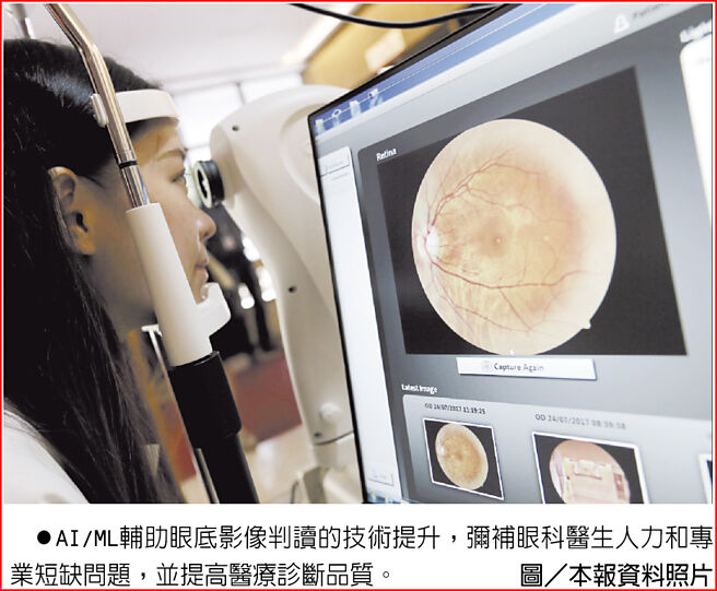 AI/ML辅助眼底影像判读的技术提升，弥补眼科医生人力和专业短缺问题，并提高医疗诊断品质。图／本报资料照片