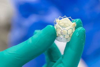 陸國產動脈支架價格翻倍賣！醫保局首次公開約詢藥械企業