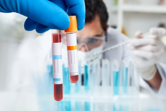 O型人易胃潰瘍！醫推1營養素 降食道癌、大腸癌風險