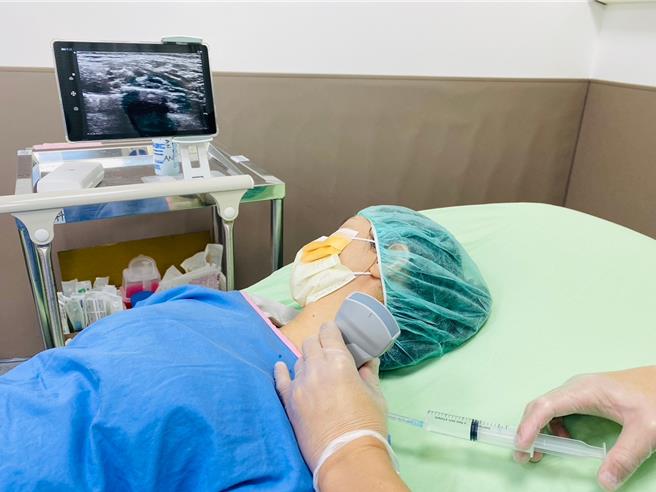 博田国际医院麻醉科主任吴明政模拟示范手持式无线超音波定位神经阻断术精准定位特定神经，注射低浓度的局部麻醉药物（示意图，非当事病患）。（博田医院提供／任义宇高雄传真）