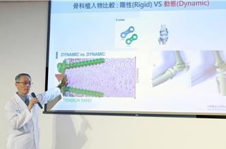 膝蓋不再打架！X型腿少年揮別疼痛 重秀筆直雙腿