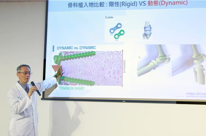 中醫大附醫院小兒骨科醫師郭建忠說明，相較傳統手術治療傷口大、治療時間久，新式導引式八字鋼板治療手術能逐步調整膝關節角度，傷口落在3-4公分，術後可快速恢復活動及跑跳，不會影響後續生長，併發症也較少。(中醫大附醫提供／馮惠宜台中傳真)