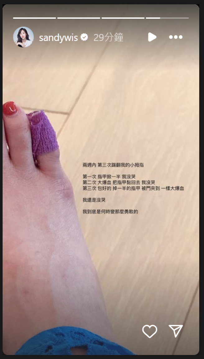 没多久后Sandy表示自己在两周内踹翻自己小拇指3次。（图／翻摄自Sandy IG ）