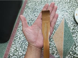 云林小二女童参加成长营遭体罚 屁股手背瘀青社会处介入调查