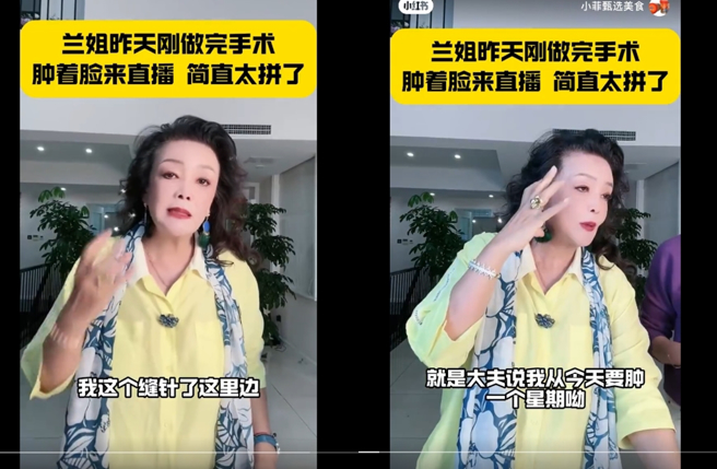 張蘭透露前一天進醫院動牙科手術。（圖／翻攝自小紅書）