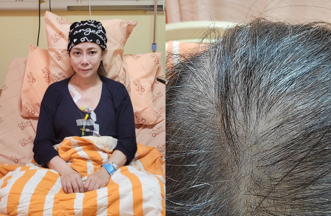 作家小彤化疗7次落髮、消瘦模样曝光。（图／脸书 两性作家小彤）