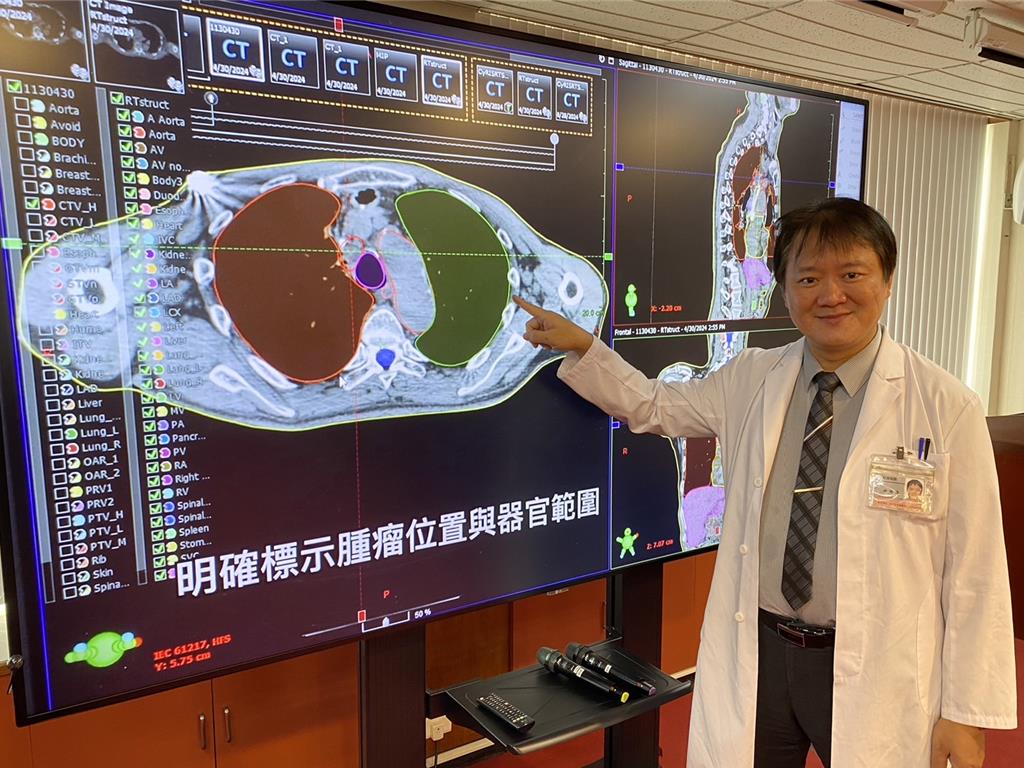 科技助陣抗癌！中榮AI器官圈註 放療成功率突破95％