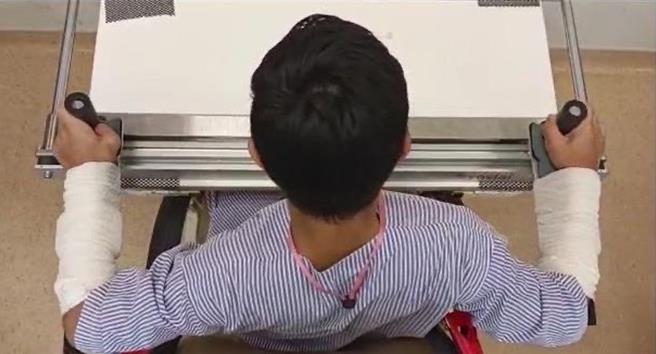 马来西亚蕉赖復健医院病童使用同动车（Synslai）做手部功能训练。（长庚医院提供）