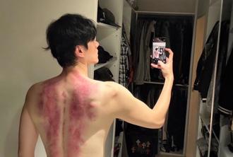 李程彬拍戲操過頭   猛爆性肝炎找上門暴瘦15公斤