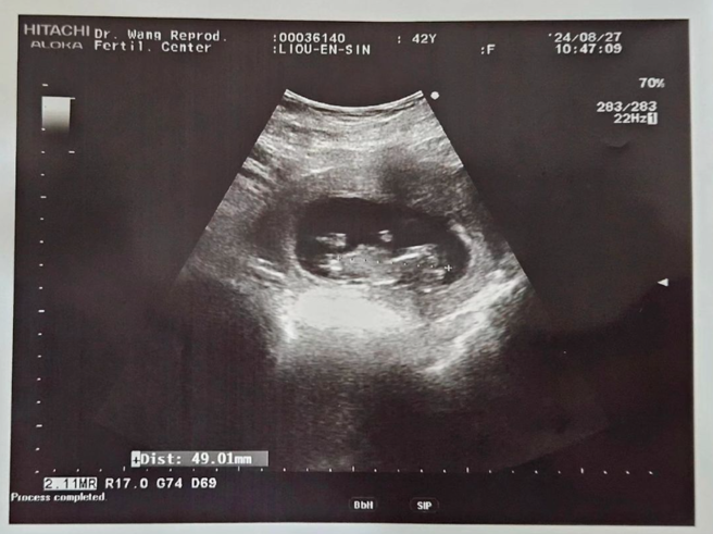 马力欧的太太怀二胎。（图／马力欧IG）