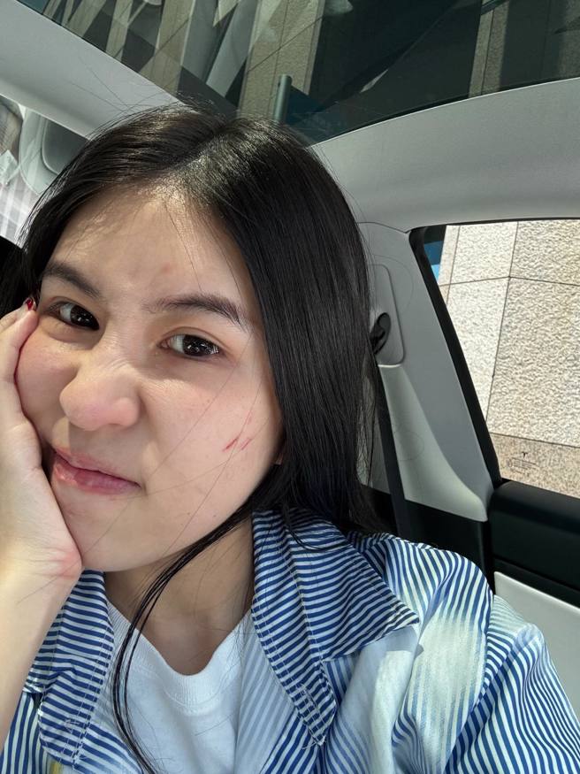 柔柔被女兒抓傷卻被1絕招安撫。（圖／Threads@rou860209）