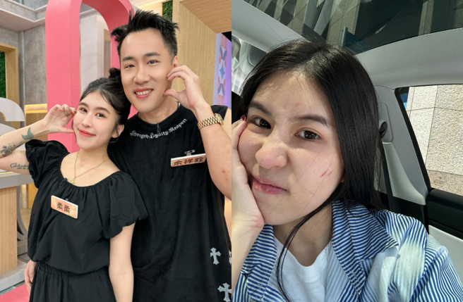 柔柔被女兒抓傷卻被1絕招安撫。（圖／IG@rou860209、Threads@rou860209）