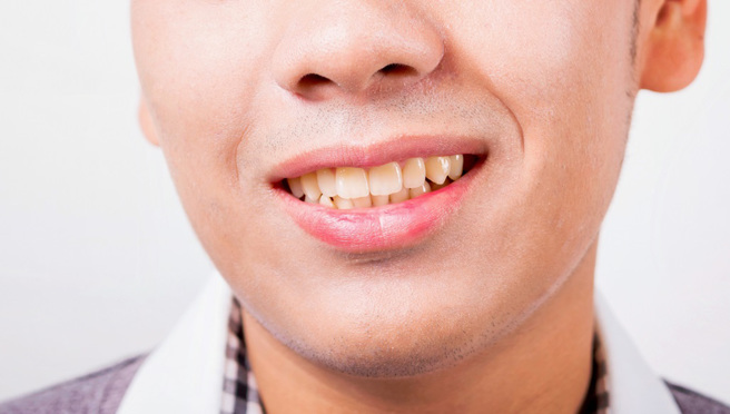 许多人都想要拥有一口美白的牙齿，然而，有些食物容易让牙齿染色，小心越吃越黄。（示意图：shutterstock／达志）