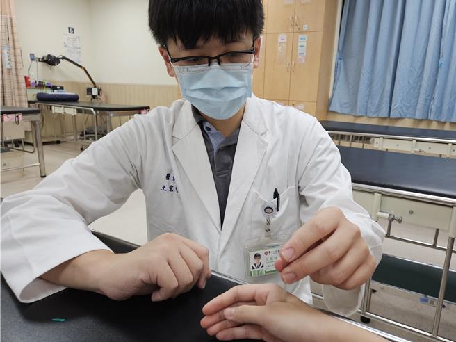 中医师以合谷穴为病人进行针灸治疗。（马偕医院提供）
