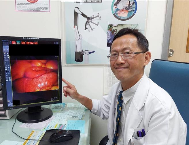 苗栗县大千综合医院外科部主任冯启彦表示，肠中风与脑中风一样，都是血管阻塞产生缺氧坏死。（大千医院提供／谢明俊苗栗传真）