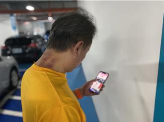 低頭族加重頸部壓力恐病變 醫師建議用「軍訓體態」減壓