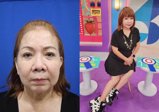 法令紋太深(左)，讓萁媽一度對自己没什麼自信，現在的萁媽(右)對自己超滿意。(萁媽瘋語錄)