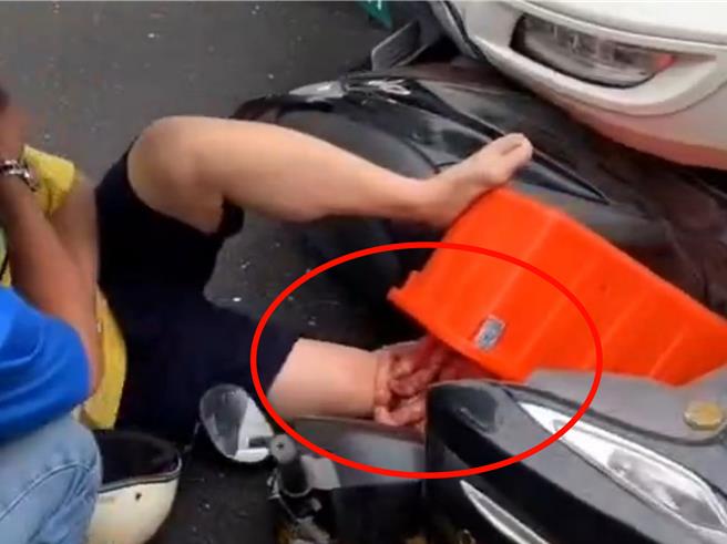 屏东东港发生大货车与机车擦撞事故，机车遭压在大货车头下，机车骑士一张貌似大腿爆裂的画面引发误会。（翻摄社会事新闻影音／罗琦文屏东传真）