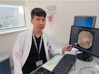 6岁童大量血便 胶囊内视镜揪出克隆氏症作怪