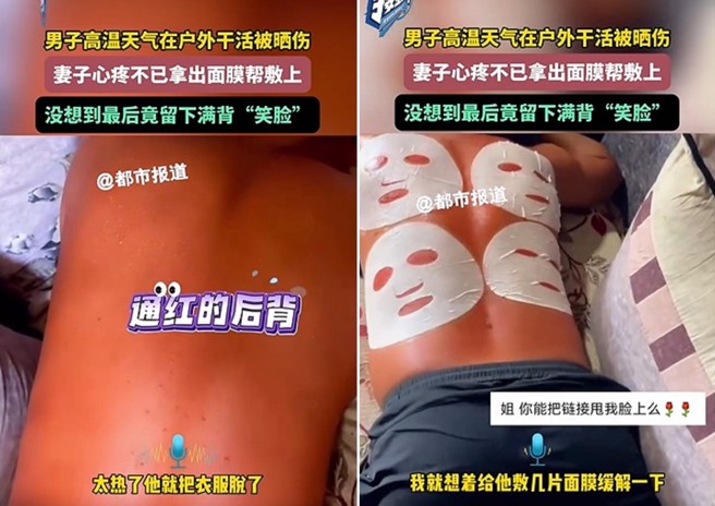 老公工作背晒伤，妻子心疼贴面膜缓解，没想到变成搞笑片段了。（图／翻摄微博）