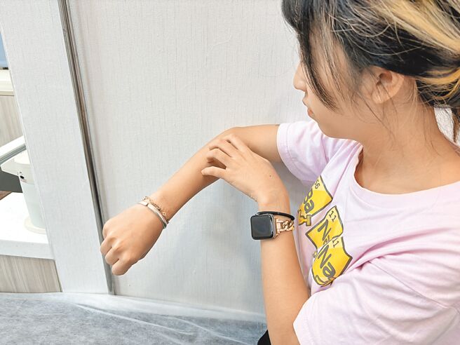 我國高達20到25萬名慢性自發性蕁麻疹患者，好發年齡為20至40歲，女性發病比例約為男性2倍。圖為抓癢示意圖。（李念庭攝）