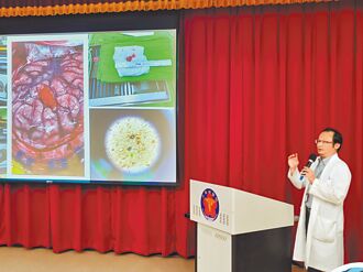 難治型癲癇占3成 手術有助控制