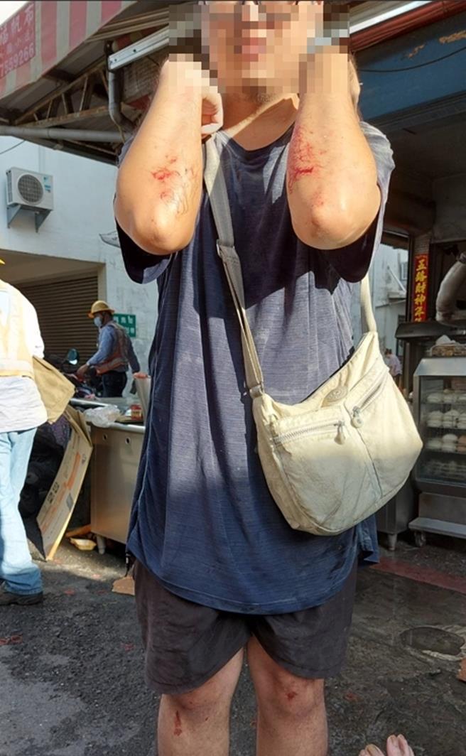 早餐店林姓老板娘的儿子仅割伤。（民眾提供／孙英哲彰化传真）