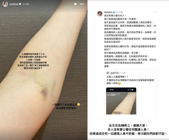 解婕翎分享抽血瘀青照遭批评，她强调没有要公审任何人。（图／翻摄自解婕翎 IG）